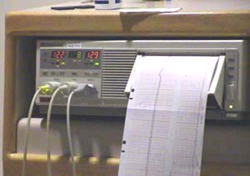 Fetal Monitors